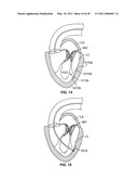 METHODS, SYSTEMS AND DEVICES FOR CARDIAC VALVE REPAIR diagram and image