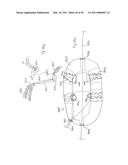 METHODS, SYSTEMS AND DEVICES FOR CARDIAC VALVE REPAIR diagram and image