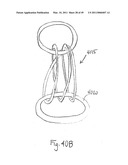 METHODS, SYSTEMS AND DEVICES FOR CARDIAC VALVE REPAIR diagram and image