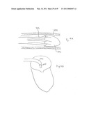 METHODS, SYSTEMS AND DEVICES FOR CARDIAC VALVE REPAIR diagram and image