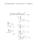 METHODS, SYSTEMS AND DEVICES FOR CARDIAC VALVE REPAIR diagram and image