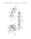 METHODS, SYSTEMS AND DEVICES FOR CARDIAC VALVE REPAIR diagram and image