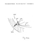 METHODS, SYSTEMS AND DEVICES FOR CARDIAC VALVE REPAIR diagram and image