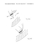 METHODS, SYSTEMS AND DEVICES FOR CARDIAC VALVE REPAIR diagram and image