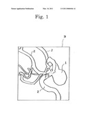 METHOD OF PRODUCING FLEXIBLE VESSEL MODEL FOR SIMULATING SURGICAL OPERATION diagram and image