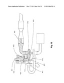 MULTI-STAGE TURBOCHARGING SYSTEM WITH THERMAL BYPASS diagram and image