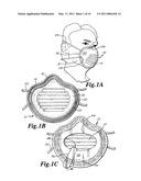 Face Mask With Seal Within Seal And Optional Bridging Seal diagram and image