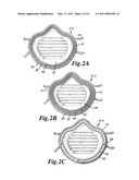 Face Mask With Seal Within Seal And Optional Bridging Seal diagram and image