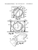 Face Mask With Seal Within Seal And Optional Bridging Seal diagram and image