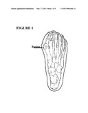 STOCKING FOR FEET WITH BUNIONS diagram and image