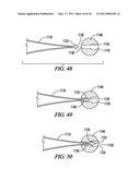 DEFORMABLE TUBE WINDING DEVICE diagram and image