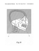 Medical X-ray apparatus diagram and image