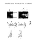 LONG LENGTH MULTIPLE DETECTOR IMAGING APPARATUS AND METHOD diagram and image