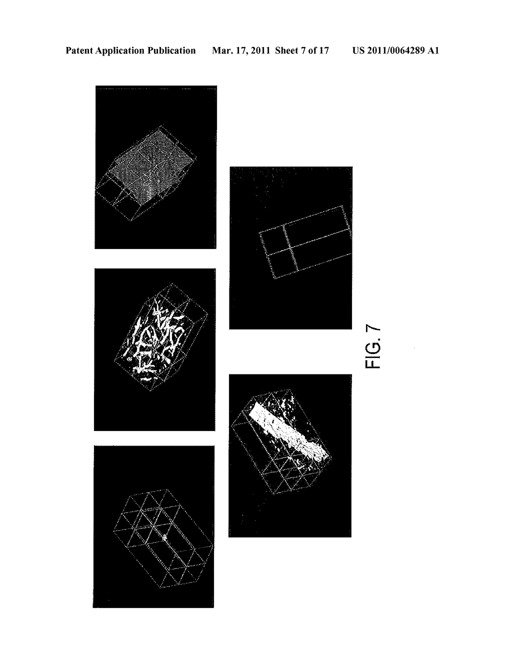 Systems and Methods for Multilevel Nodule Attachment Classification in 3D CT Lung Images - diagram, schematic, and image 08