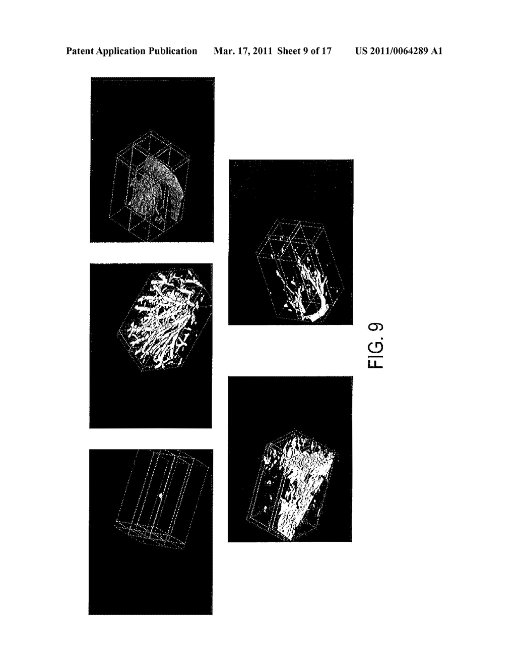 Systems and Methods for Multilevel Nodule Attachment Classification in 3D CT Lung Images - diagram, schematic, and image 10