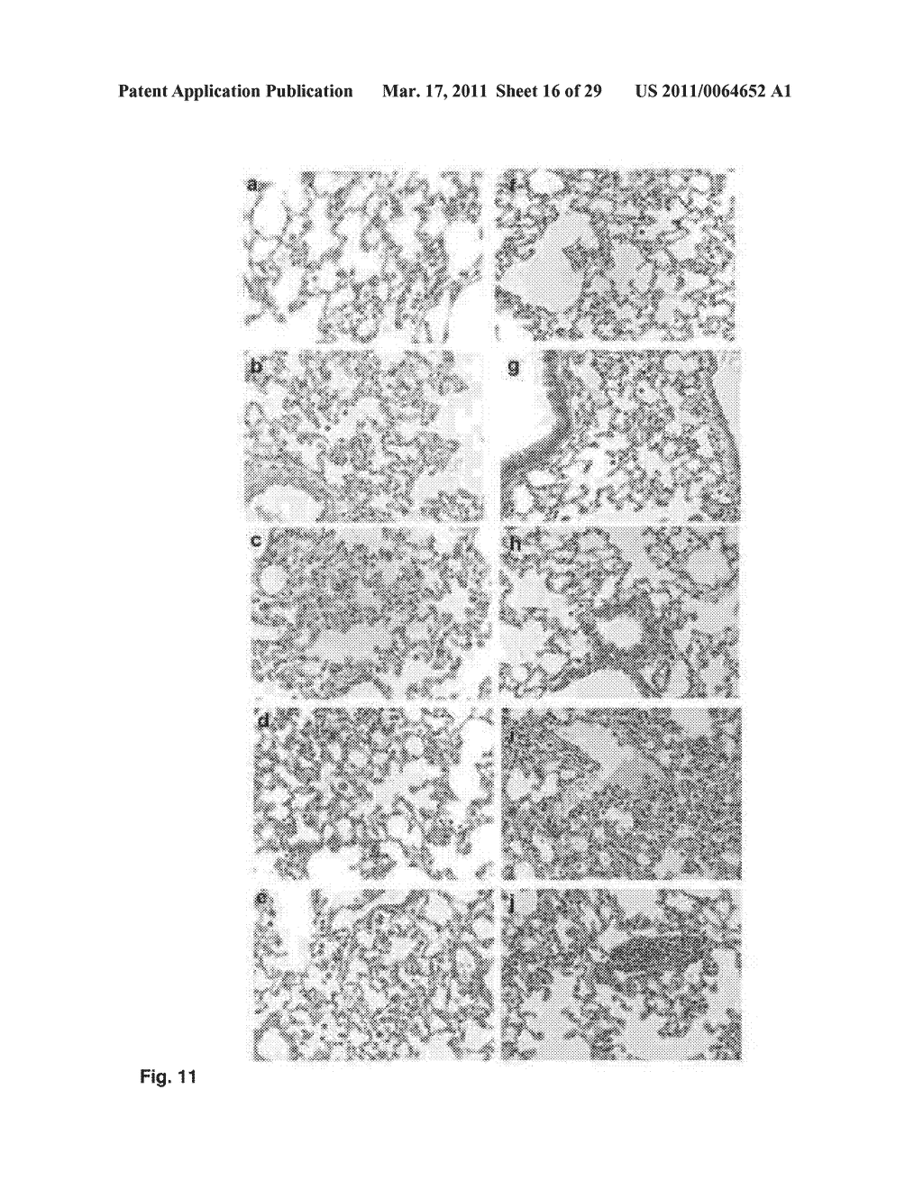 NANOPARTICLES FOR TARGETED DELIVERY OF ACTIVE AGENTS TO THE LUNG - diagram, schematic, and image 17