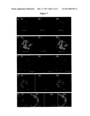 NEURAL STEM CELLS diagram and image