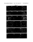 NEURAL STEM CELLS diagram and image