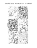 HUMAN ANTI-CANCER ANTIBODIES diagram and image