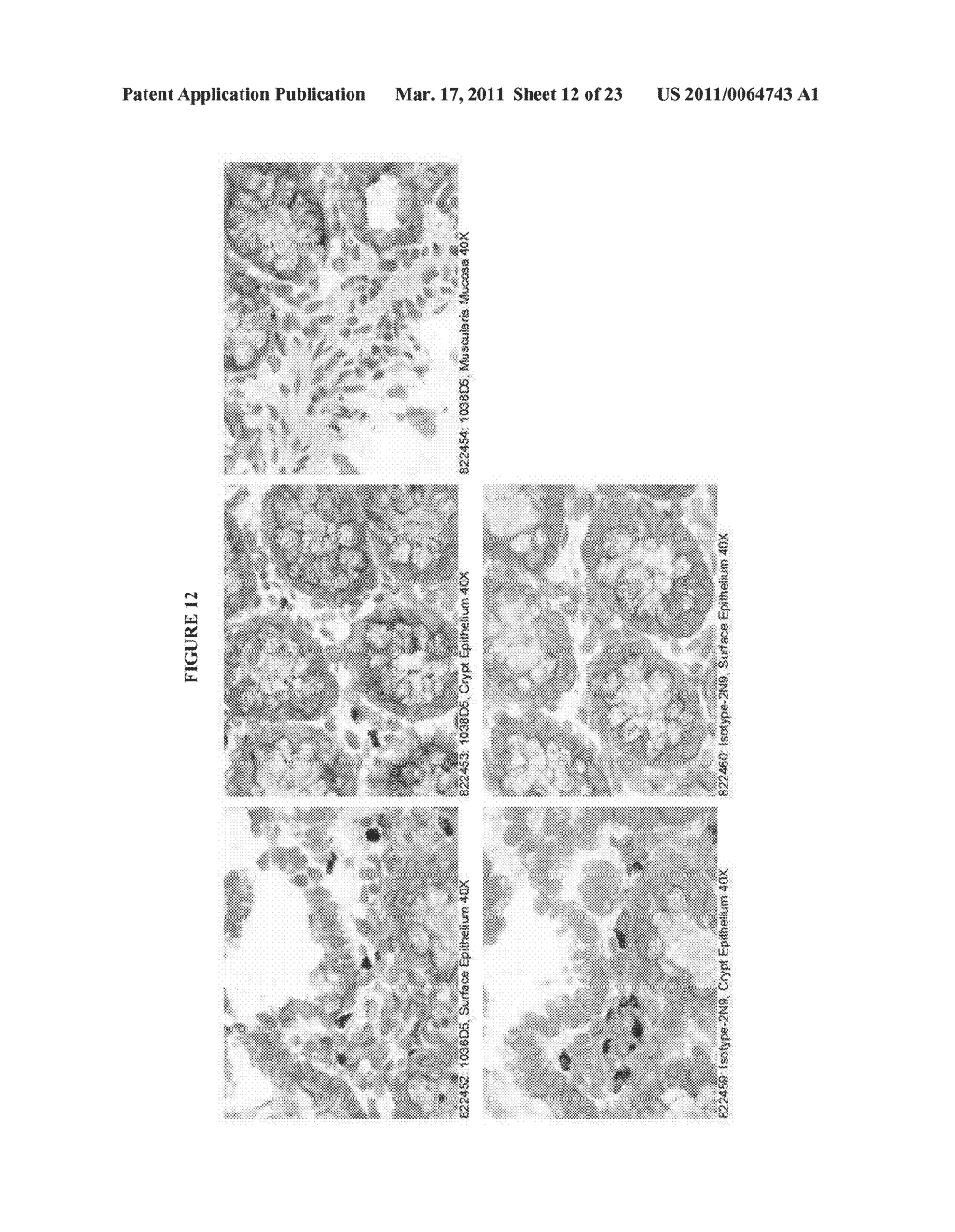 HUMAN ANTI-CANCER ANTIBODIES - diagram, schematic, and image 13