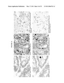 HUMAN ANTI-CANCER ANTIBODIES diagram and image