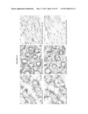 HUMAN ANTI-CANCER ANTIBODIES diagram and image