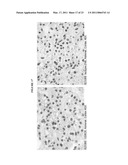 HUMAN ANTI-CANCER ANTIBODIES diagram and image