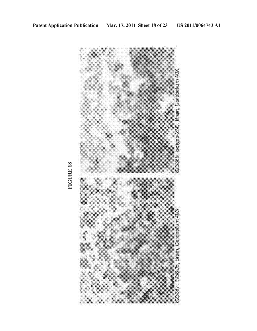 HUMAN ANTI-CANCER ANTIBODIES - diagram, schematic, and image 19