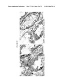 HUMAN ANTI-CANCER ANTIBODIES diagram and image