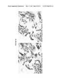 HUMAN ANTI-CANCER ANTIBODIES diagram and image