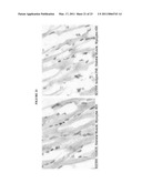 HUMAN ANTI-CANCER ANTIBODIES diagram and image