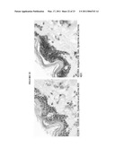 HUMAN ANTI-CANCER ANTIBODIES diagram and image