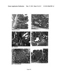 DOCOSAHEXANOIC ACID AS INHIBITOR OF H. PYLORI diagram and image