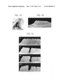 Orthodontic methods and devices diagram and image