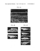 Orthodontic methods and devices diagram and image