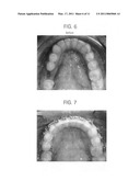 Orthodontic methods and devices diagram and image