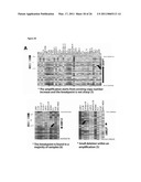 RECURRENT GENE FUSIONS IN PROSTATE CANCER diagram and image