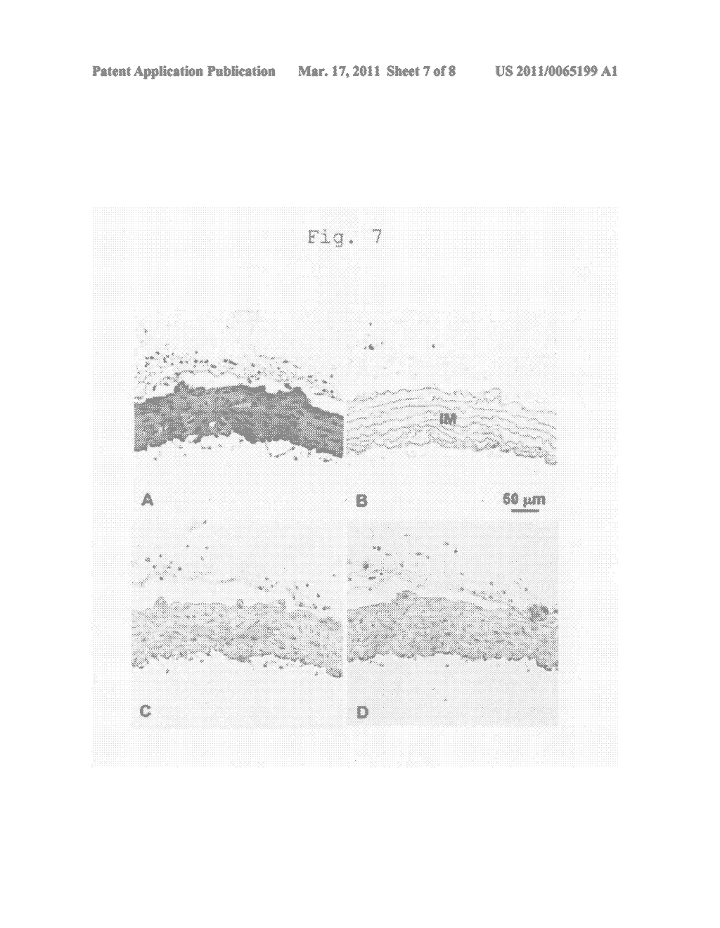 Atherosclerosis marker and use thereof - diagram, schematic, and image 08