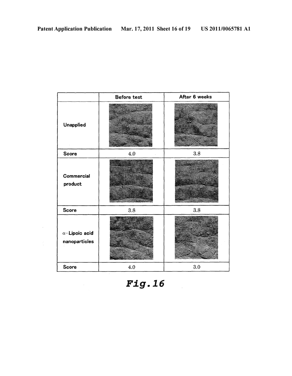 Alpha-LIPOIC ACID NANOPARTICLES AND METHODS FOR PREPARING THEREOF - diagram, schematic, and image 17