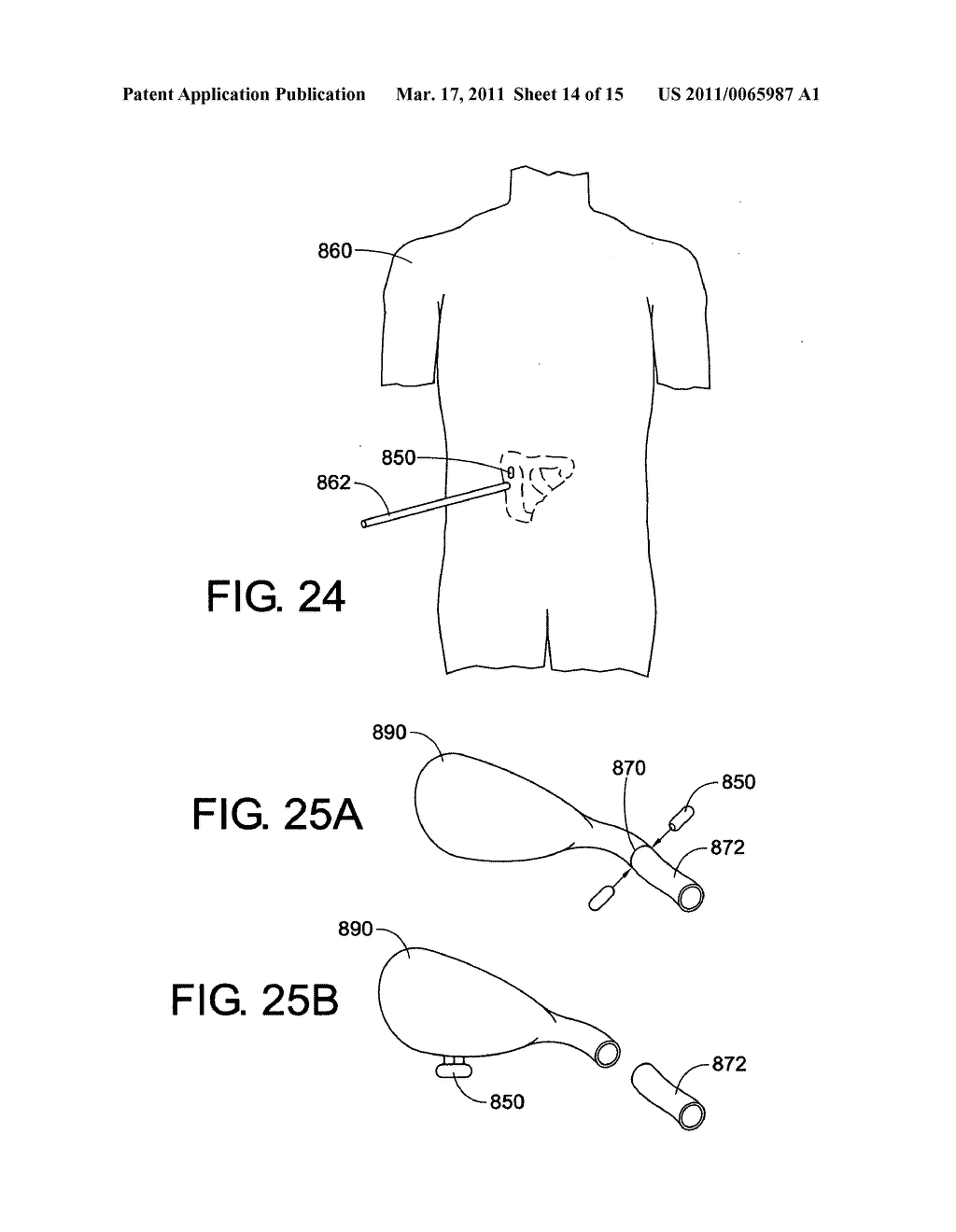 MINIATURE INGESTIBLE CAPSULE - diagram, schematic, and image 15