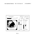 SYSTEM FOR ASSESSMENT OF COLONOSCOPE MANIPULATION diagram and image