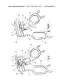 Instrument for endoscopic surgery diagram and image