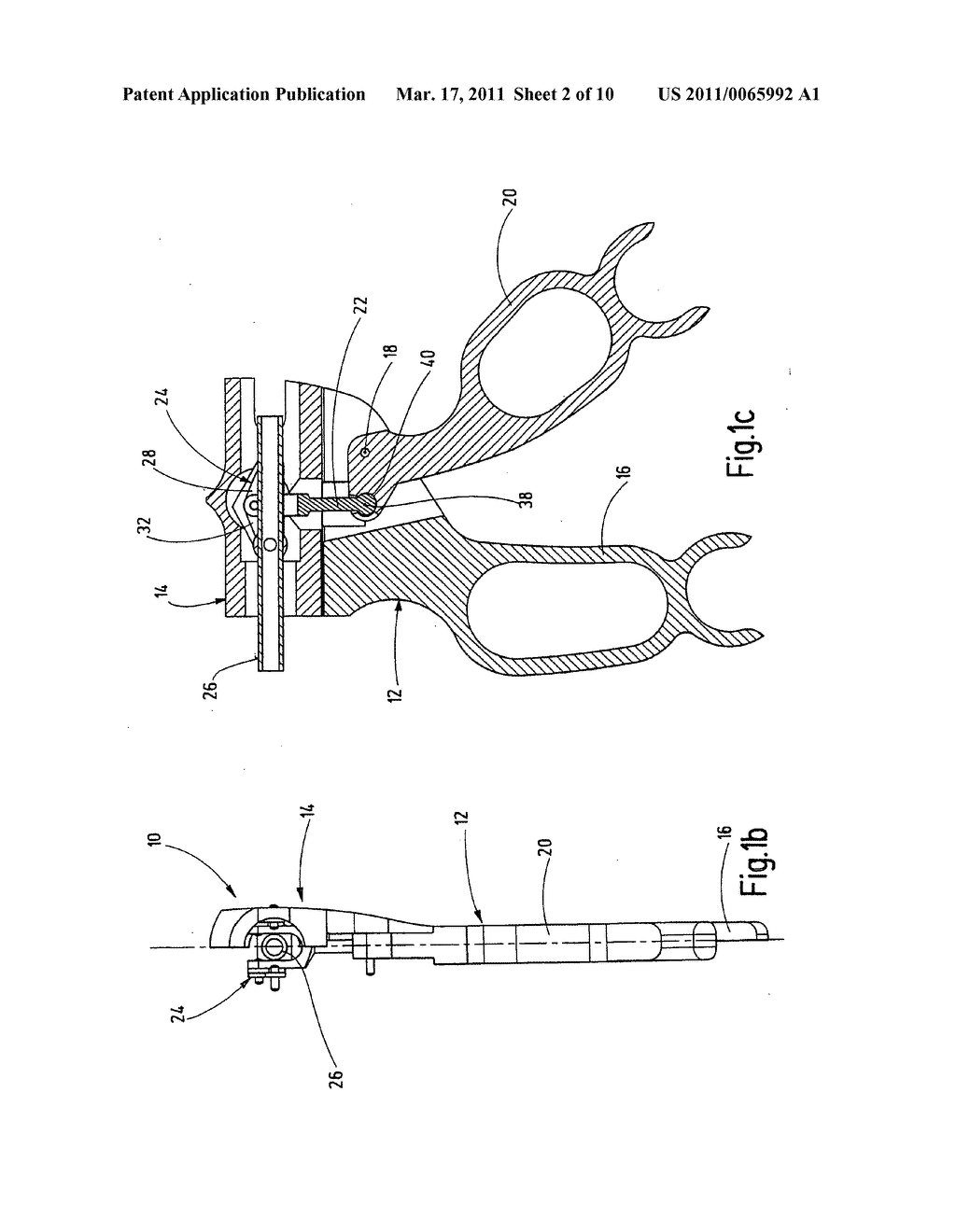 Instrument for endoscopic surgery - diagram, schematic, and image 03