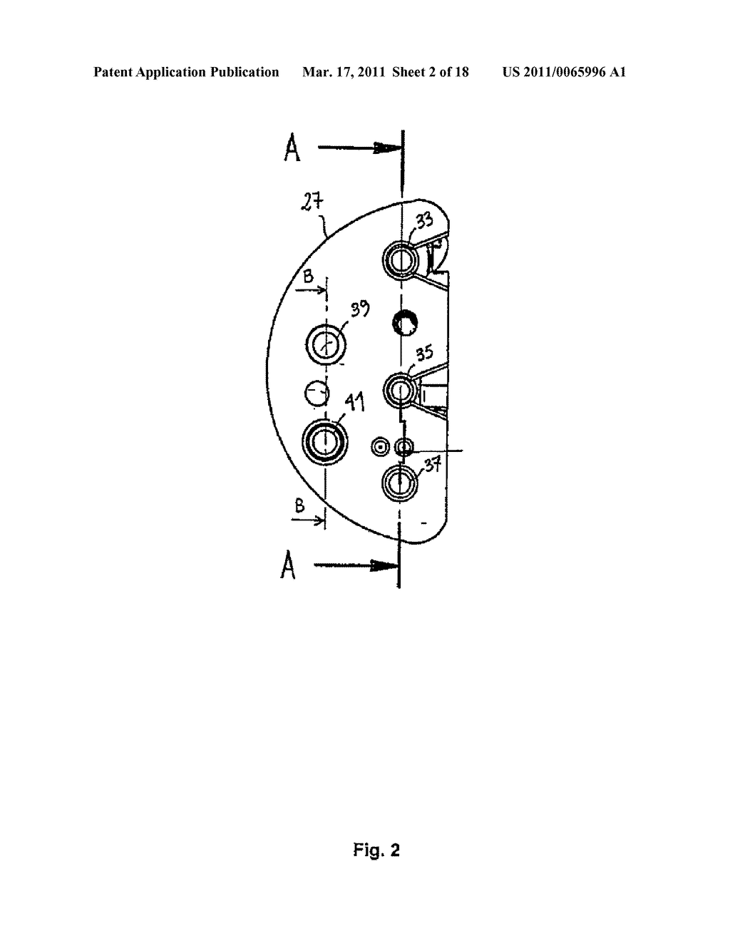 CASSETTE FOR IRRIGATION OR ASPIRATION MACHINE FOR ENDOSCOPY - diagram, schematic, and image 03