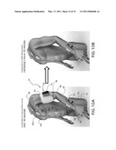 SYSTEM FOR MEASURING VITAL SIGNS DURING HEMODIALYSIS diagram and image