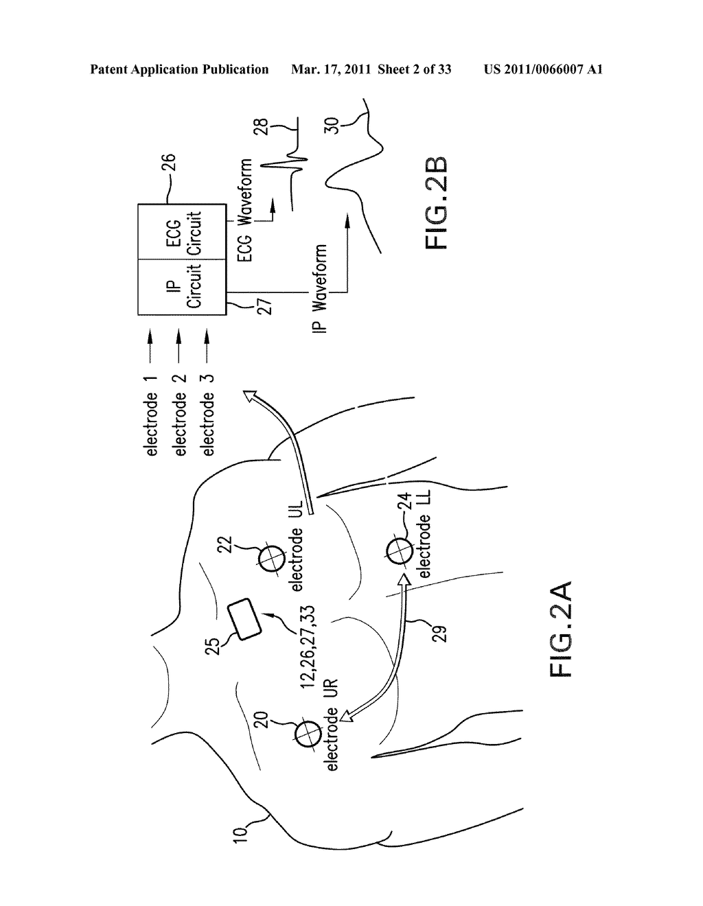 BODY-WORN MONITOR FOR MEASURING RESPIRATION RATE - diagram, schematic, and image 03