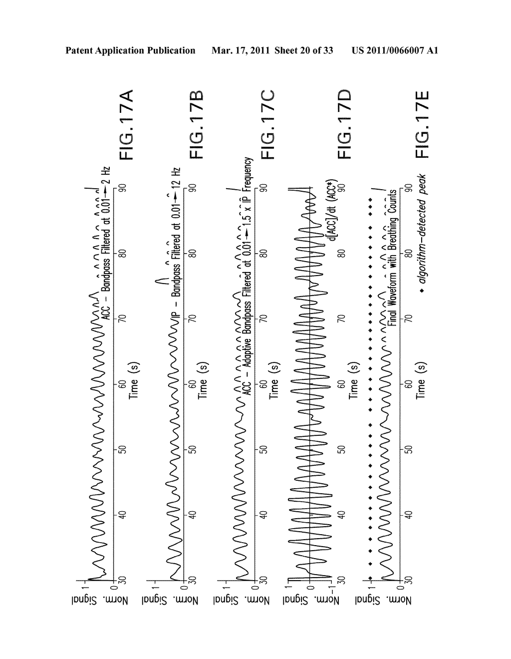 BODY-WORN MONITOR FOR MEASURING RESPIRATION RATE - diagram, schematic, and image 21