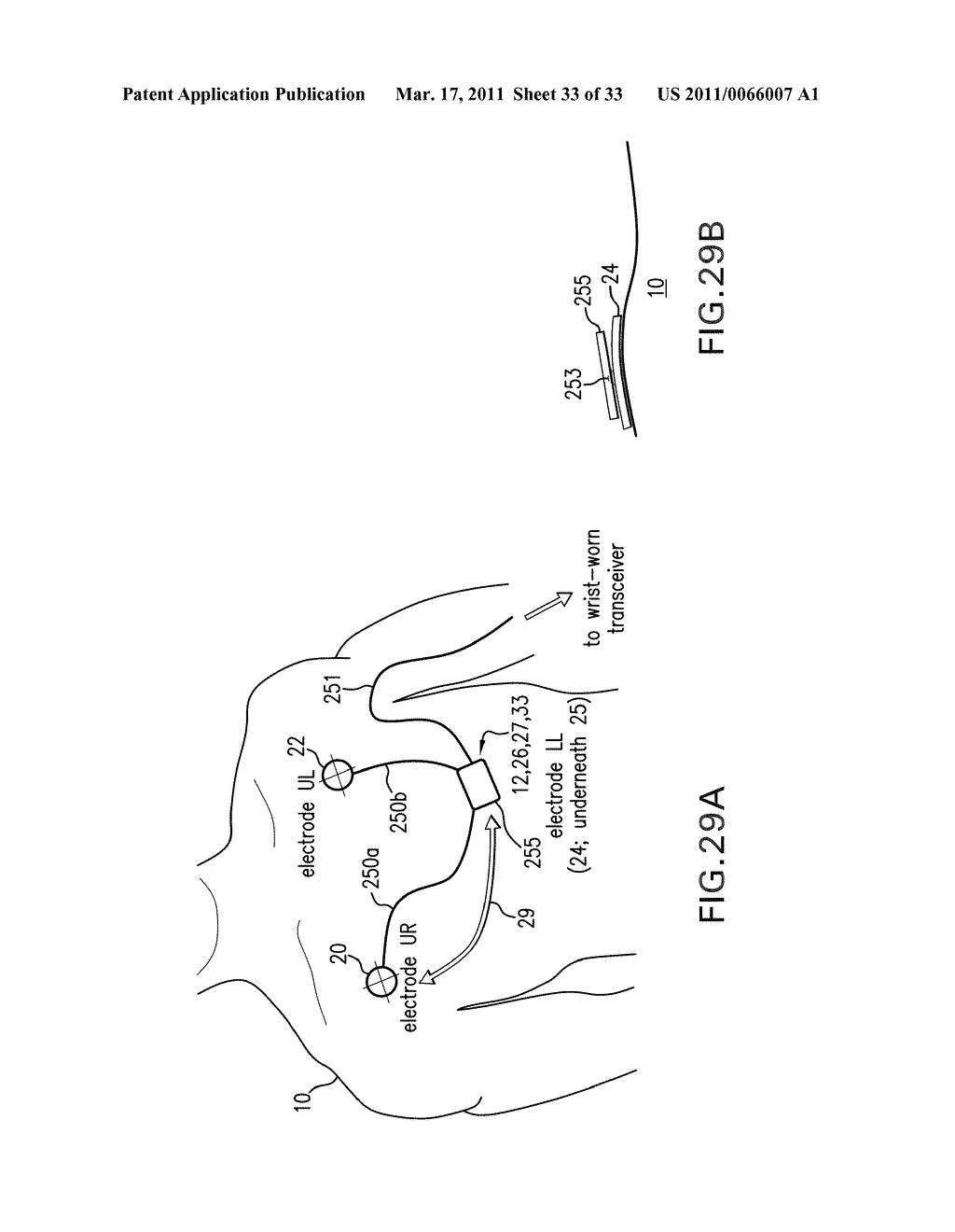 BODY-WORN MONITOR FOR MEASURING RESPIRATION RATE - diagram, schematic, and image 34