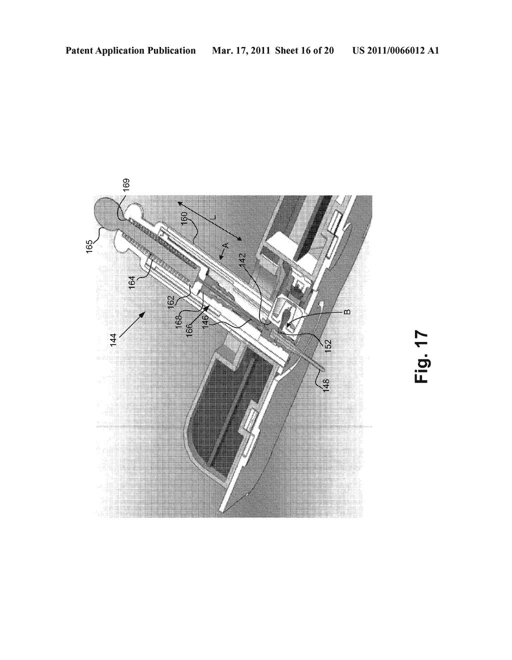 NEEDLE INSERTION SYSTEMS AND METHODS - diagram, schematic, and image 17