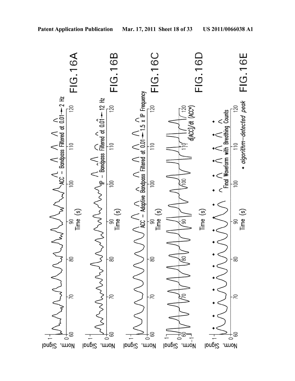 BODY-WORN MONITOR FOR MEASURING RESPIRATION RATE - diagram, schematic, and image 19